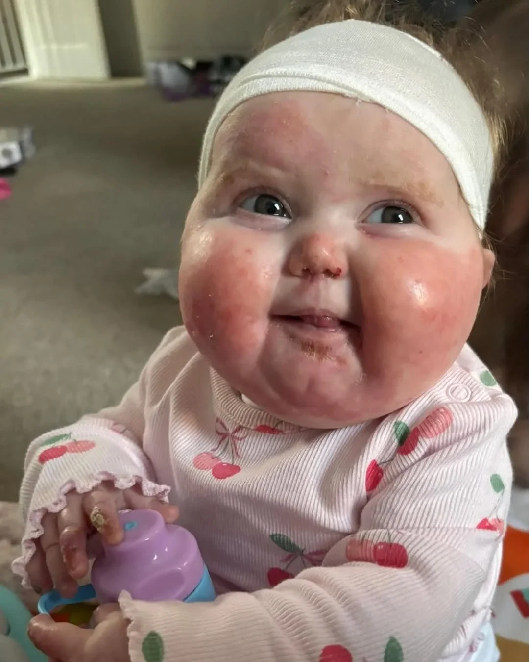 Vivi sorrindo apesar da dor